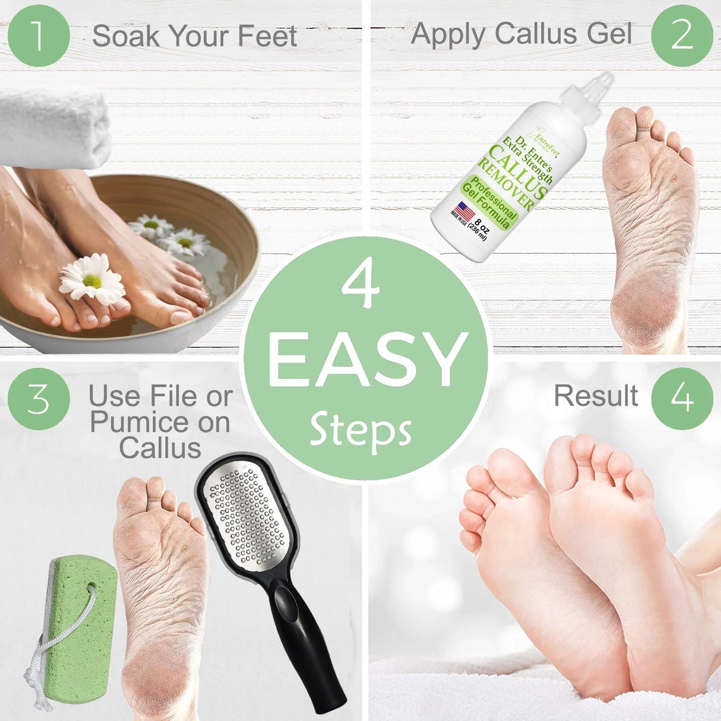 Dr. Entre's Callus Remover Gel – Foot Callus Remover Spa Kit with Pedicure Tools, Dead Skin Scrubber