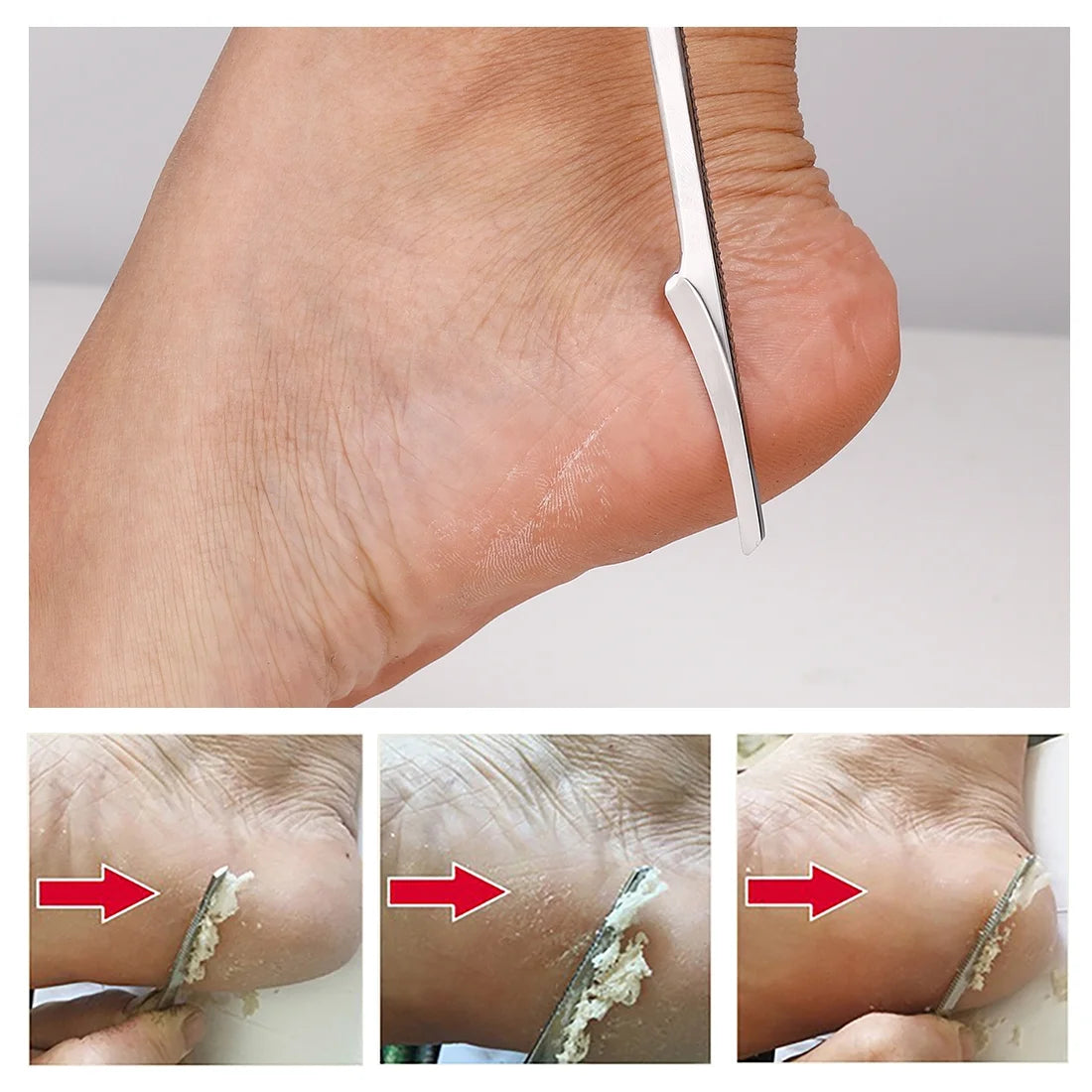 Professional Corn Plane Callus Remover – Razor Cutter with 10 Extra Sharp Refill Blades for Pedicure Foot Care