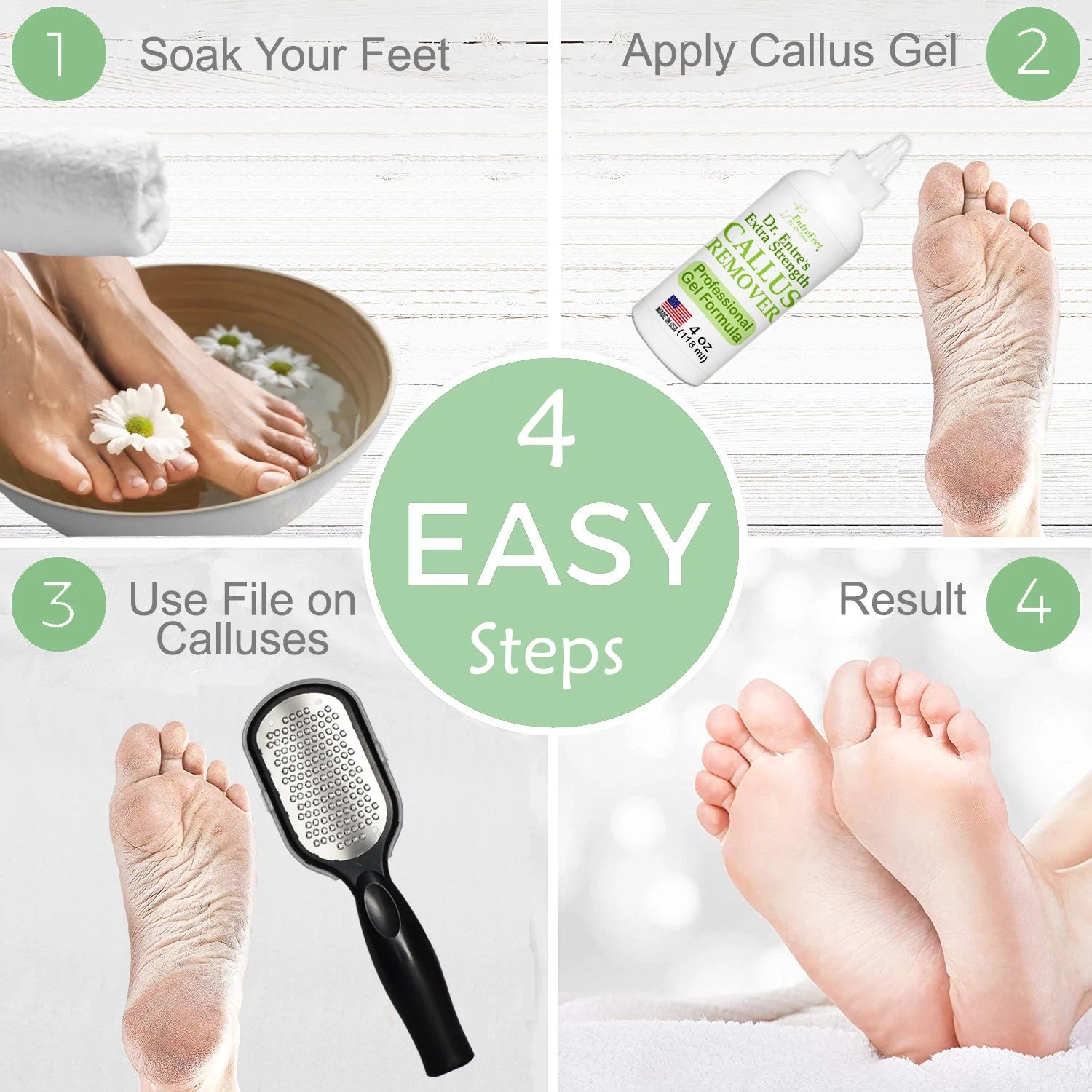 Dr. Entre's Extra Strength Callus Remover Gel & Foot File – 4 oz Pedicure Spa Kit for Dead Skin & Callus Removal