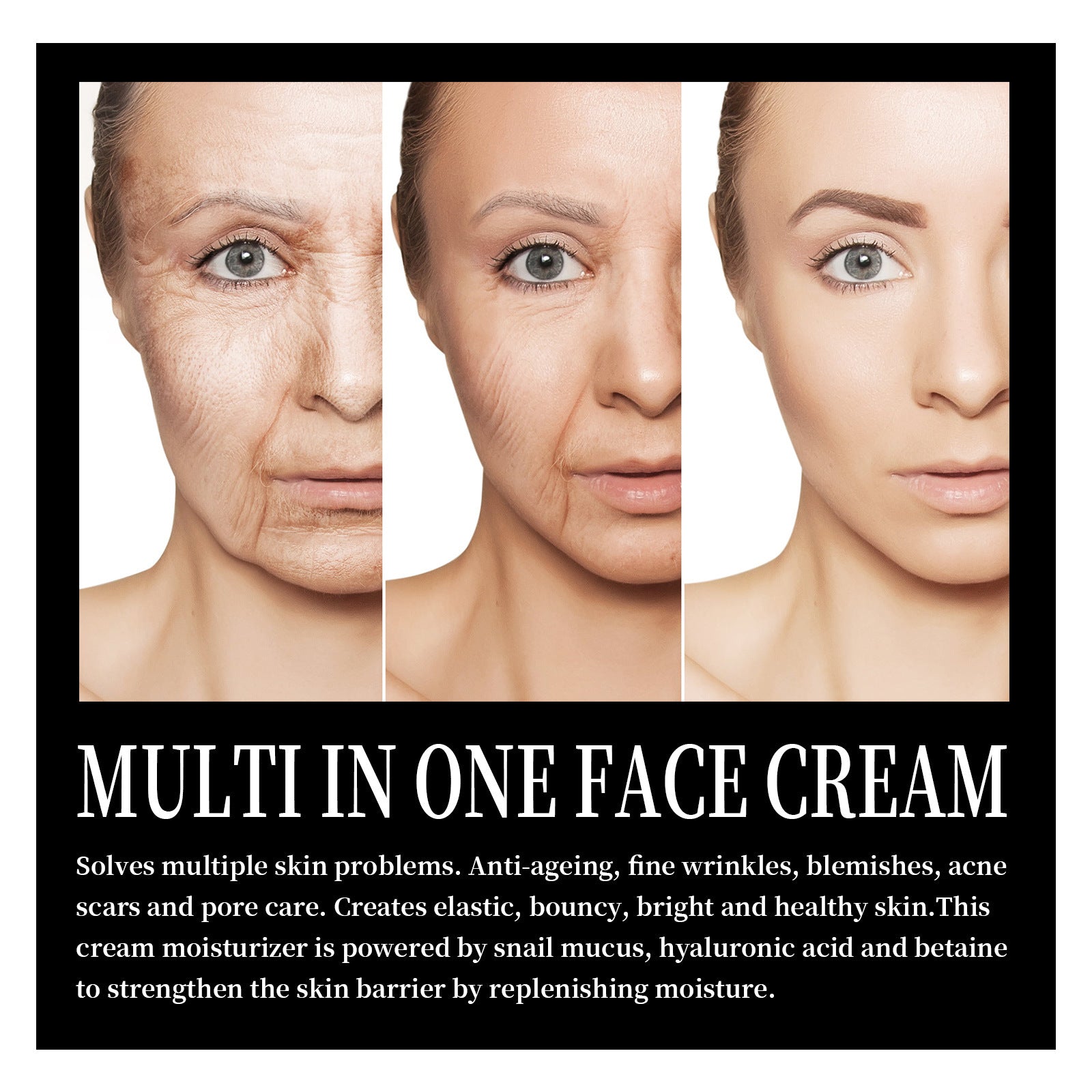 LUNOON  Snail Cream Fading Wrinkle French Lines Replenishment Firming Skin Anti-Aging