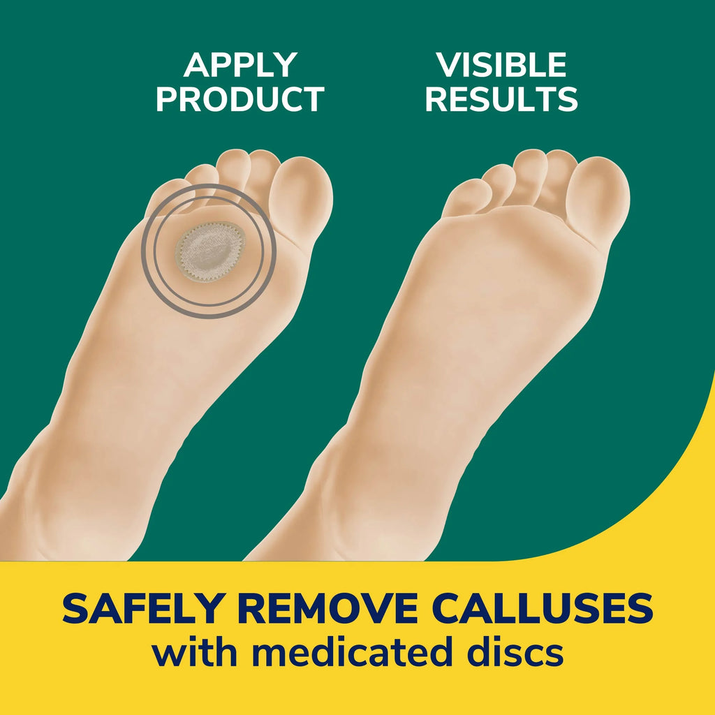Callus Remover Cushions & Softens – 4 Count Pack