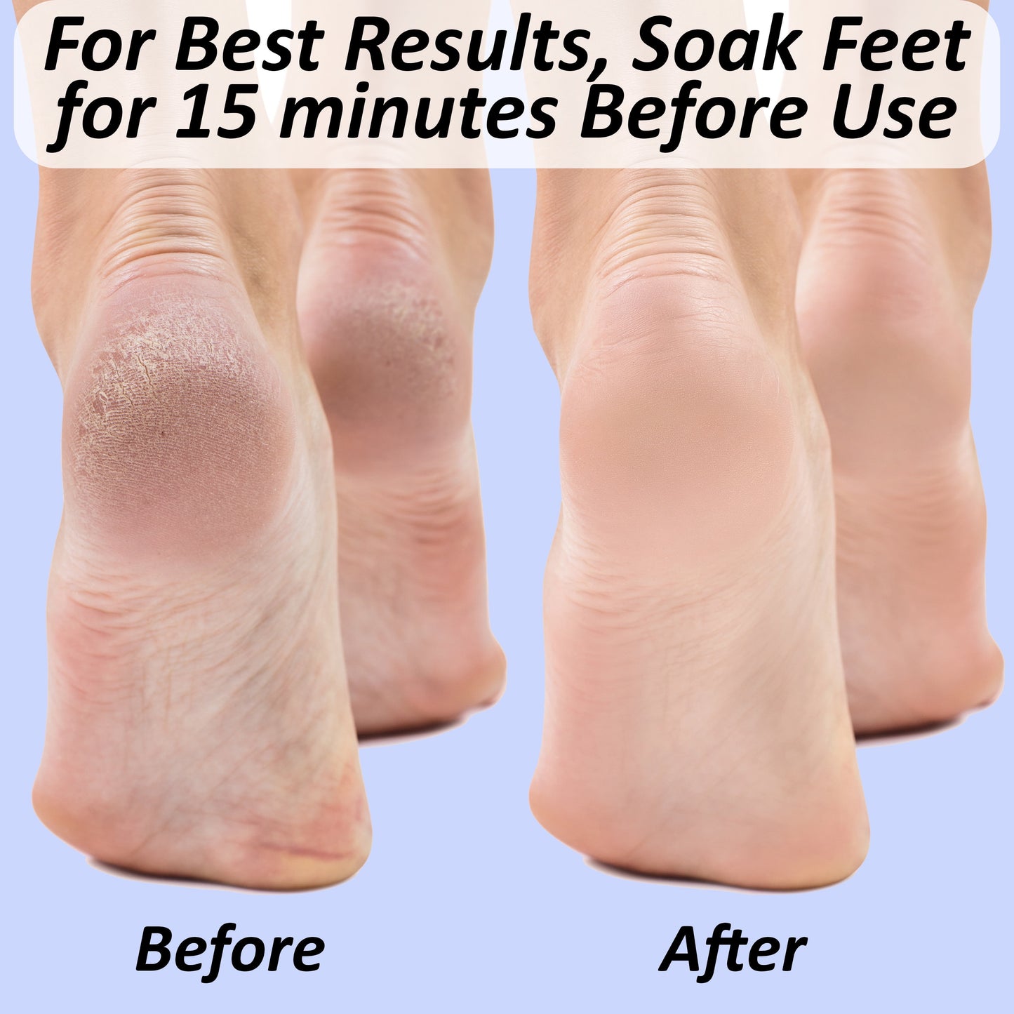 2-Pack Double-Sided Foot Files – Callus Remover & Dead Skin Scraper for Pedicure Foot Care