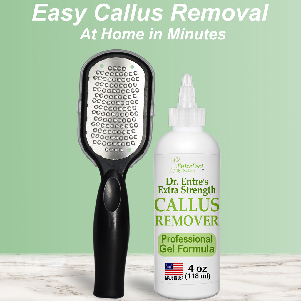 Dr. Entre's Extra Strength Callus Remover Gel & Foot File – 4 oz Pedicure Spa Kit for Dead Skin & Callus Removal