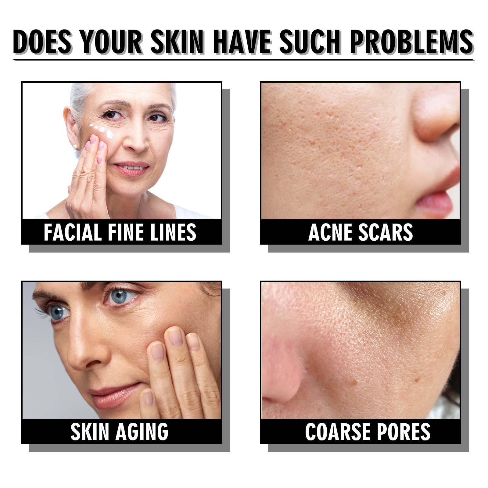 LUNOON  Snail Cream Fading Wrinkle French Lines Replenishment Firming Skin Anti-Aging