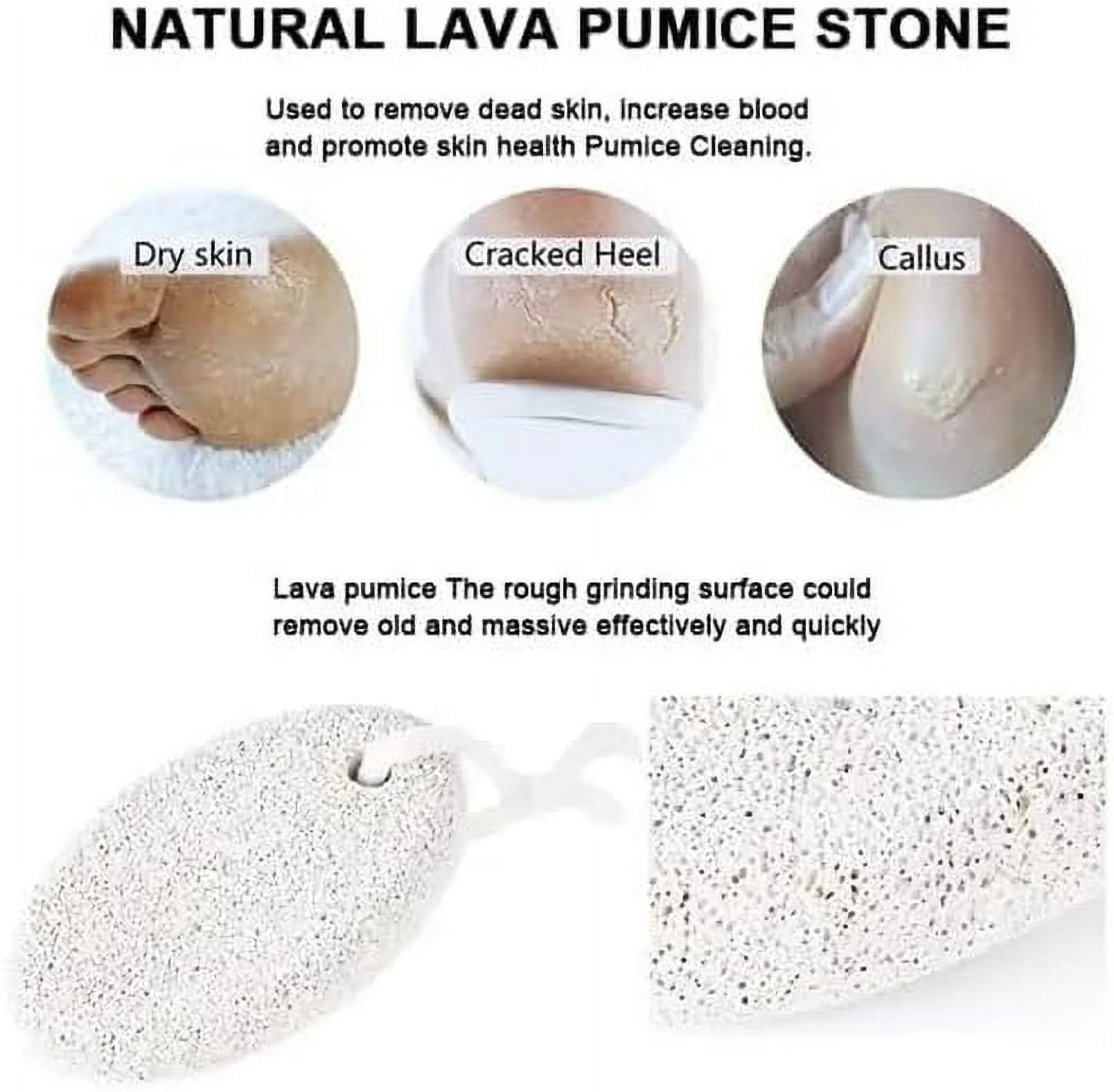 Natural Pumice Stone for Feet – Pedicure Callus Remover & Skin Exfoliator