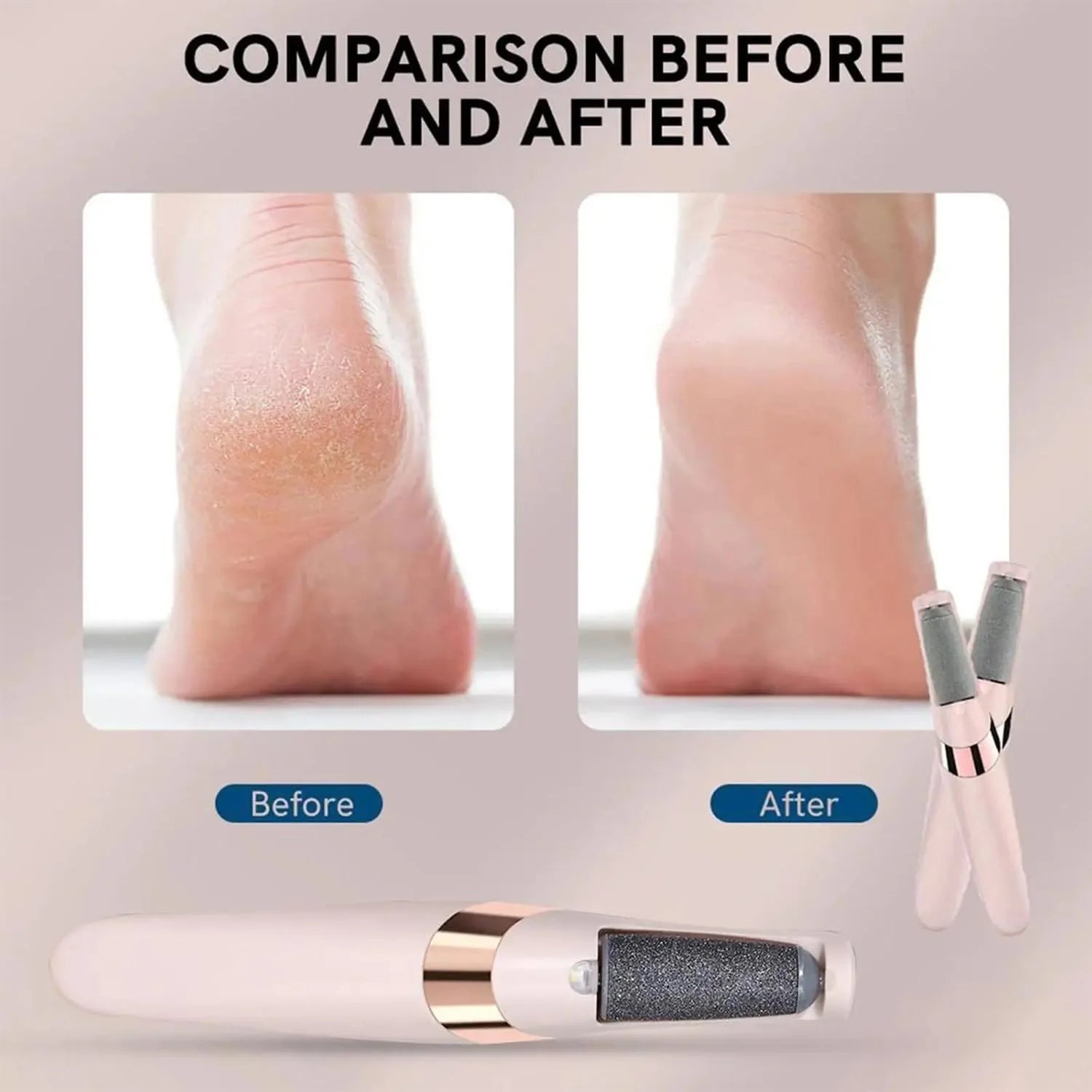 Pedicure Electronic Foot File – Callus & Hard Skin Remover, Foot Care Tool