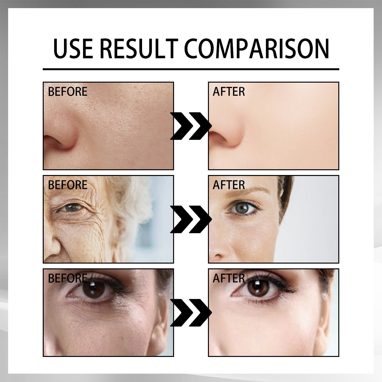 LUNOON  Snail Cream Fading Wrinkle French Lines Replenishment Firming Skin Anti-Aging