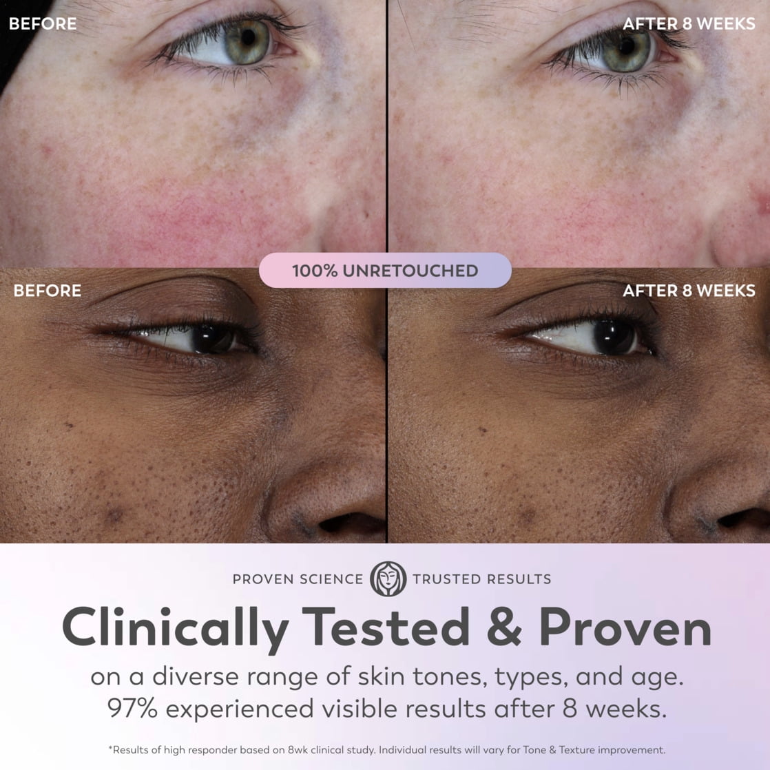 Olay Super Serum, 5-in-1 Skin Enhancing Face Serum, 1.0 oz, For Brightening Dull or Dry Skin