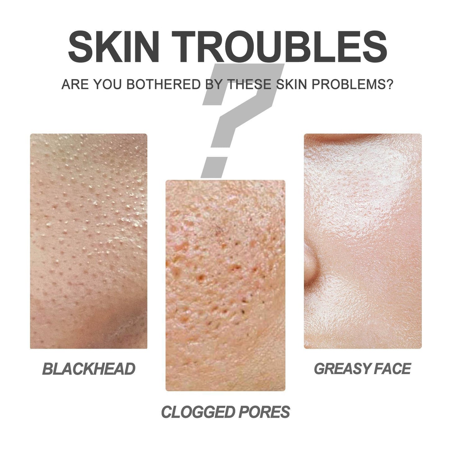 EELHOE Blackhead nose patch