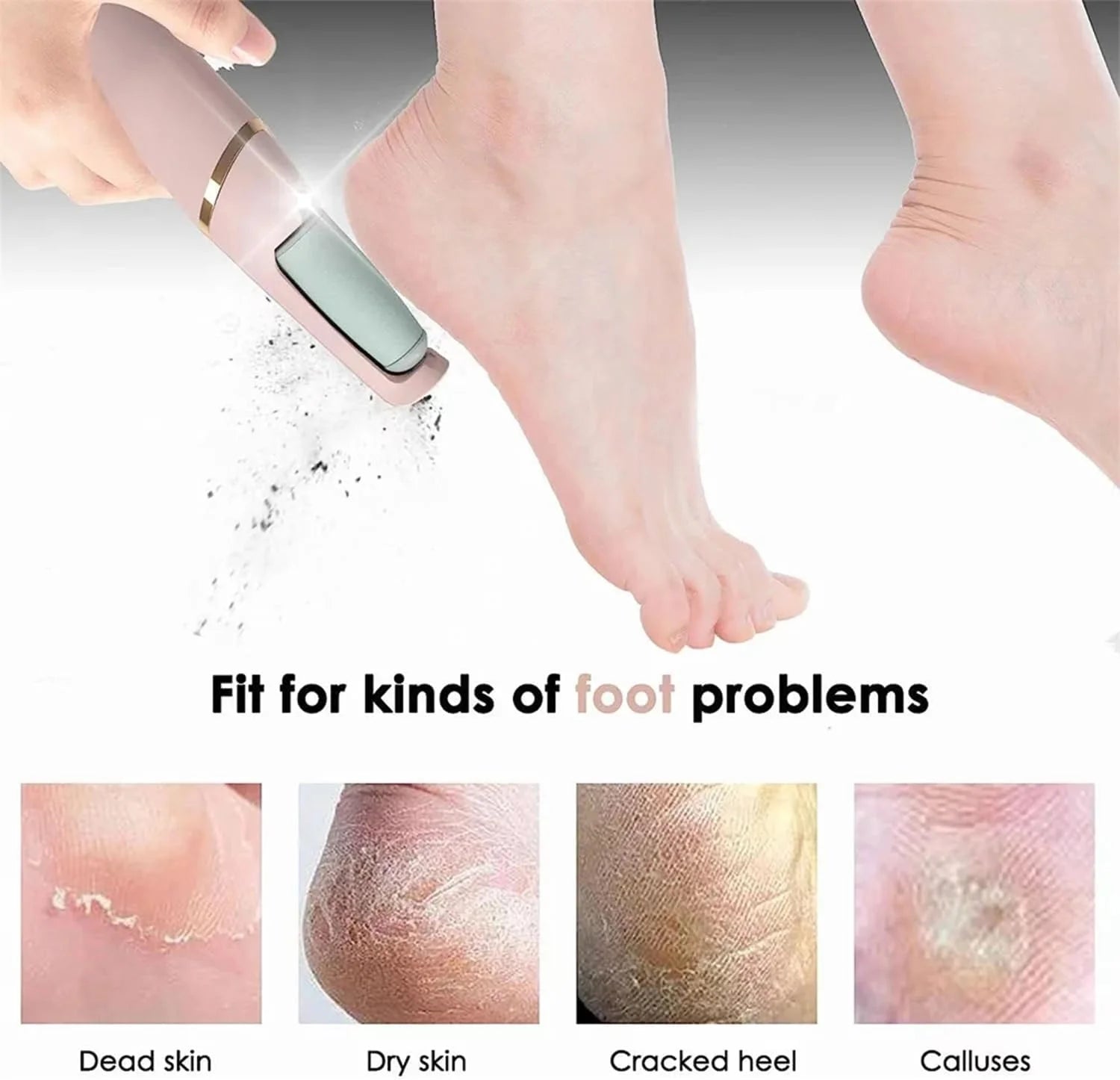 Pedicure Electronic Foot File – Callus & Hard Skin Remover, Foot Care Tool